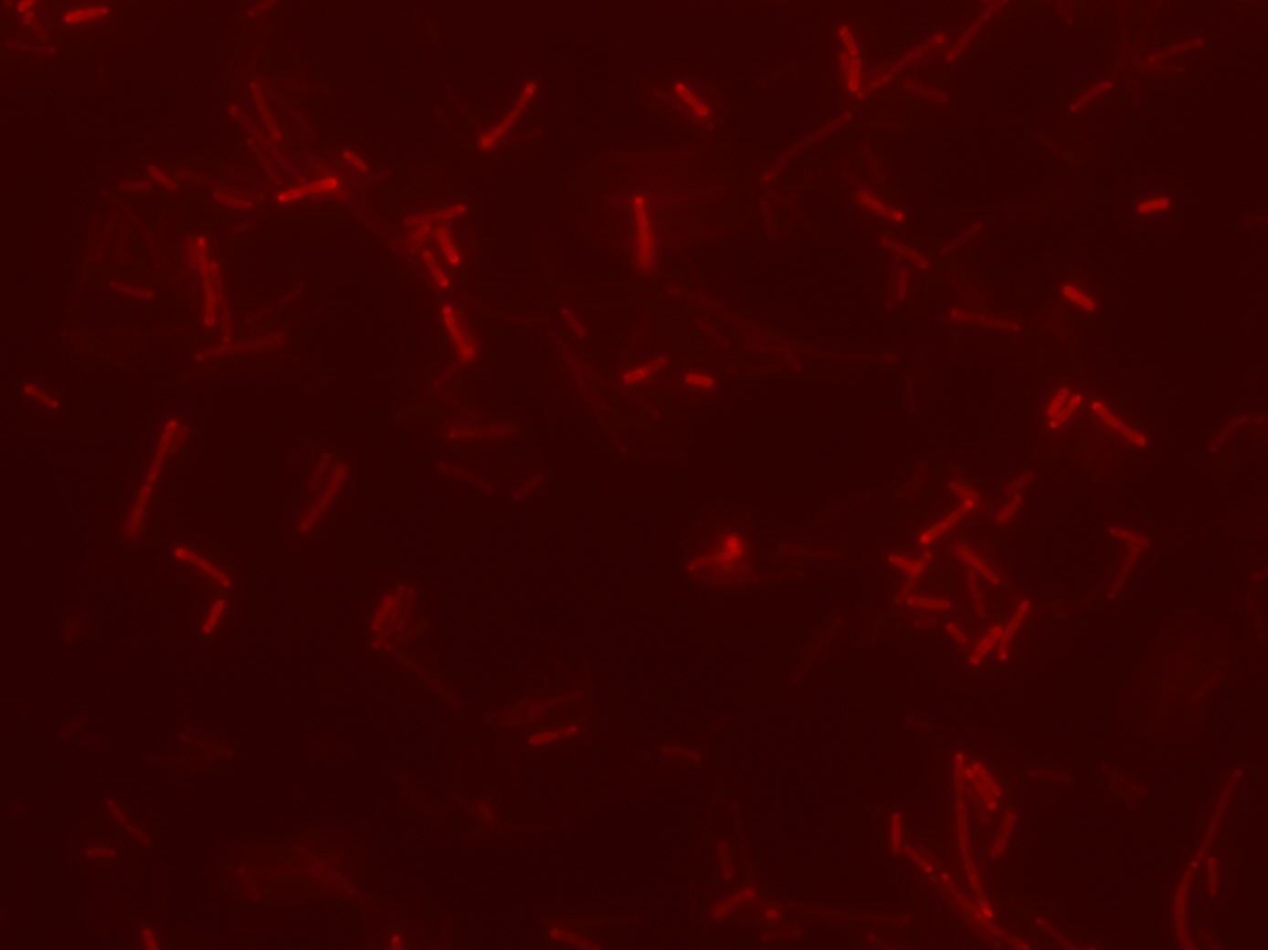 rot fluoreszierende stäbchenförmige Bakterien unter dem Mikroskop
